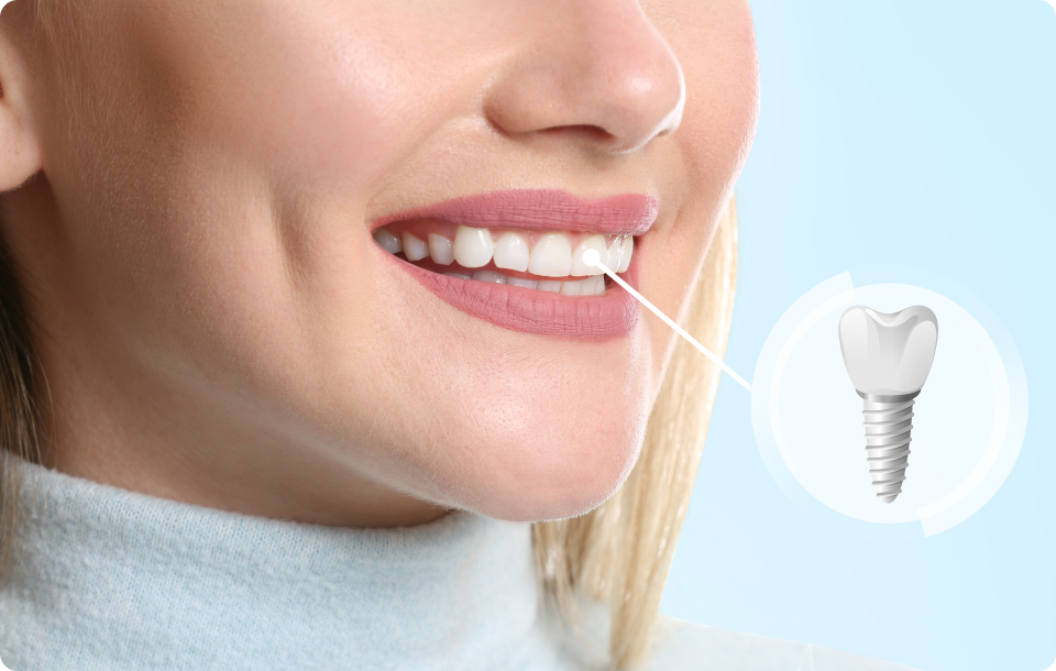 Dentiste près de Eybens