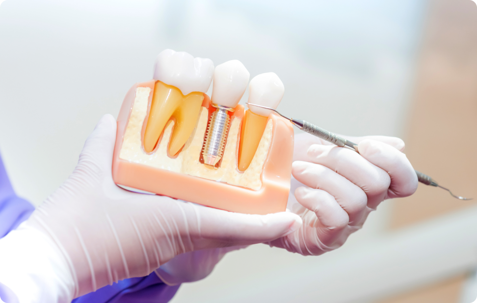 Implant près de Grenoble