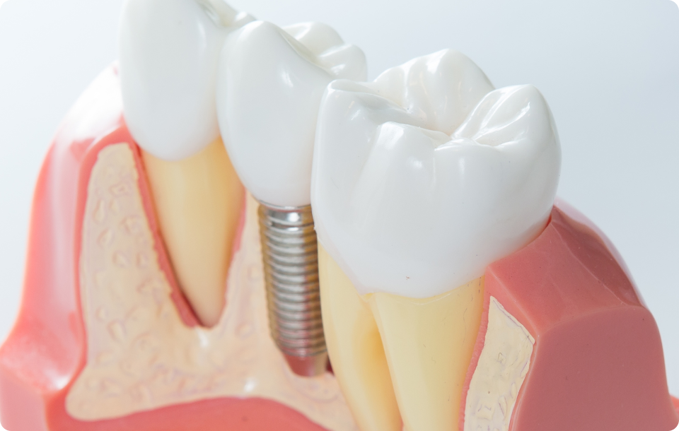 Dentiste près de Vizille